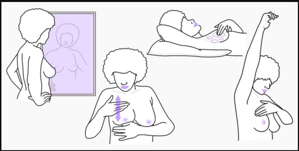 que-significa-birads-iv-en-una-mamografia-quito-salud